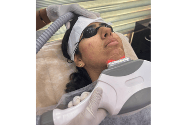 Hydra Facial