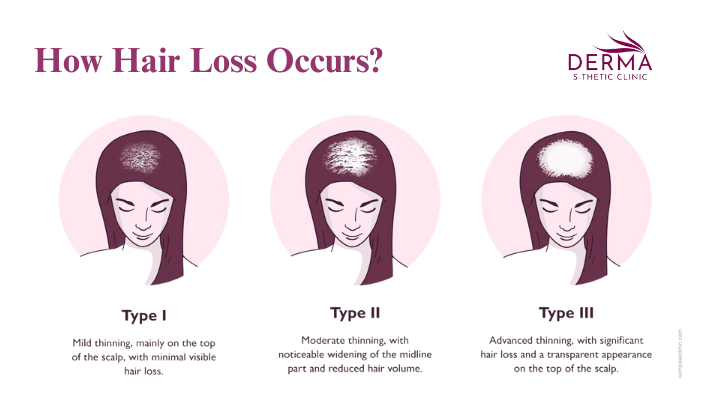 laser-hair-removal treatment